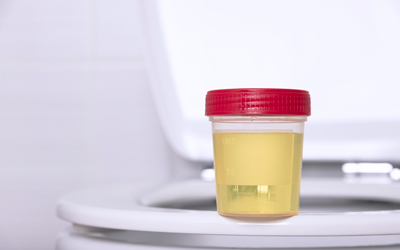 Материалы для сбора анализа - Квинмед Материалы для сбора анализа - Квинмед